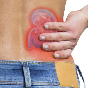 Kidney Stone Treatment in Chennai