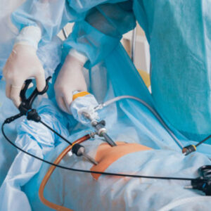 Laparoscopic Treatment in Chennai