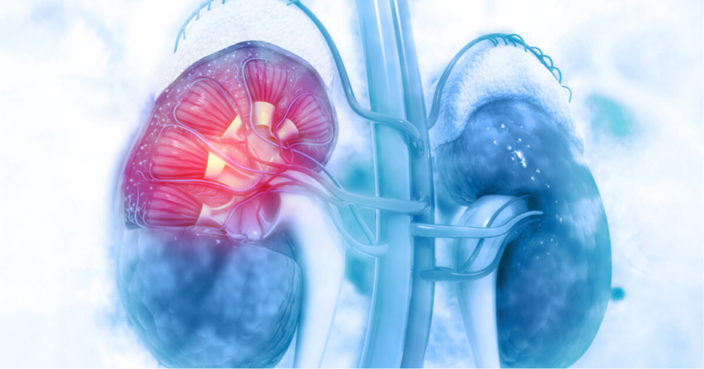 Best Kidney Hospital in Chennai